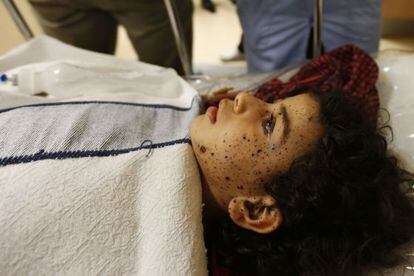 Uma menina palestina, ferida nos ataques, chora ao ser tratada.