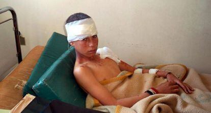 Menino ferido em um hospital de Hama (Síria).