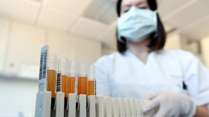 Amostras de sangue e plasma em um laboratório na Alemanha que, assim como o Brasil, investiga a cura do coronavírus.