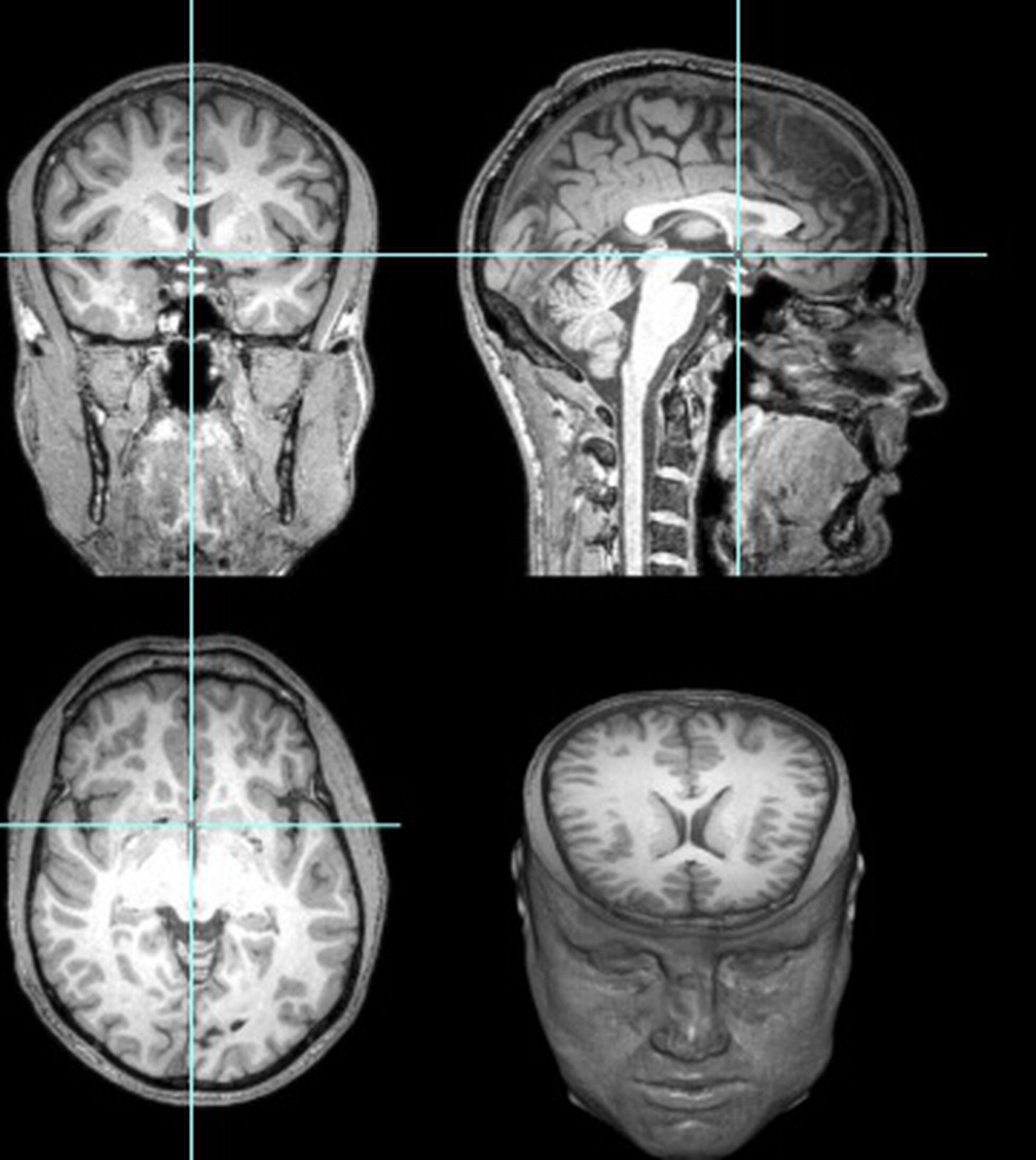 URGENTEEE!!!! O poder é como um tabuleiro de xadrez tridimensional PORQUE a  configuração da 