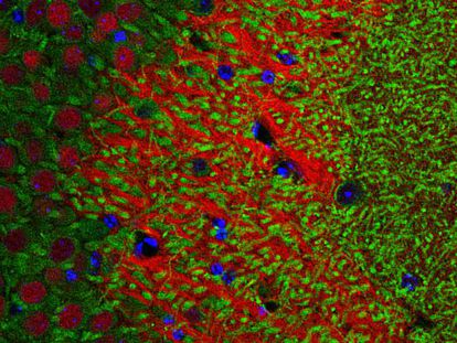 Detecção da proteína (em verde) do gene Crtc1 em neurônios do hipocampo de um camundongo.