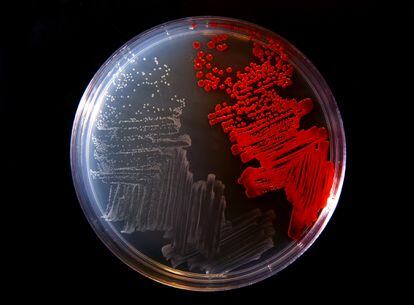 Um cultivo de bactérias em laboratório.