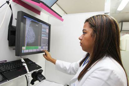20% das latinas tem uma variante genética que reduz o risco de sofrer câncer de mama em 40%.