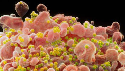 Imagem microscópica do vírus do HIV.
