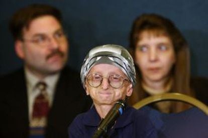 John Tacket, que tinha progeria e faleceu em 2004