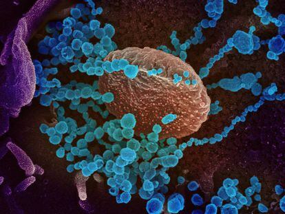 <b>O vírus que mudou tudo.</b> Imagem de microscópio eletrônico de varredura mostra o SARS-CoV-2 (colorido em azul) emergindo da superfície de células cultivadas em laboratório.