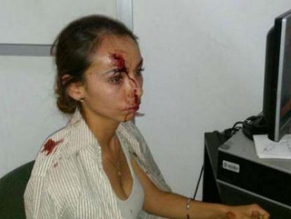 Karla Janeth Silva após a agressão em uma imagem divulgada nas redes sociais.