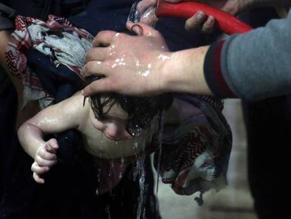 Uma criança é tratada em um hospital de Duma depois do suposto ataque químico.
