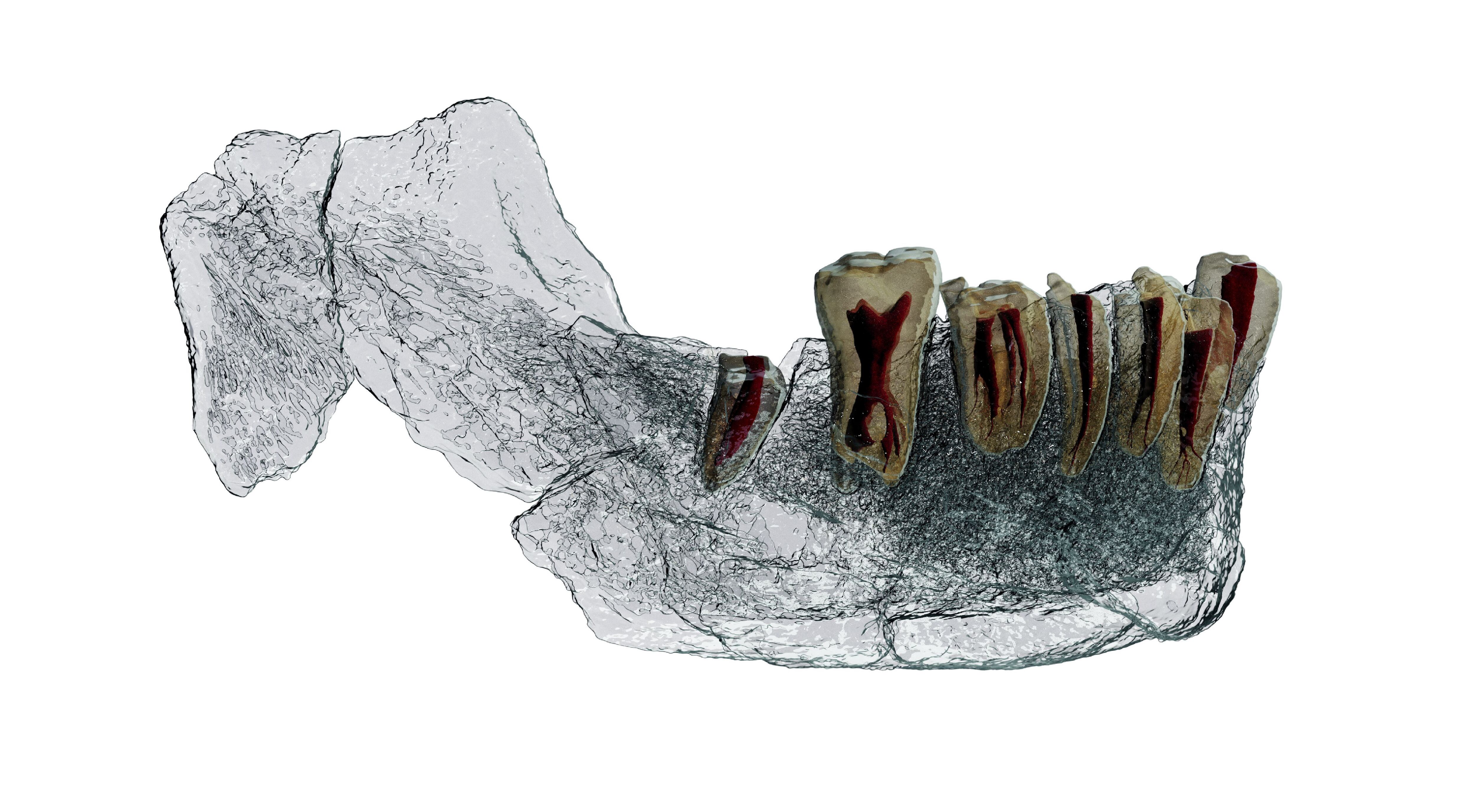 Imagem radiográfica da mandíbula do ‘Homo’ de Nesher Ramla descoberta em Israel.