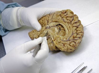 Cérebros em estudo na Fundação CEM, em Madri.
