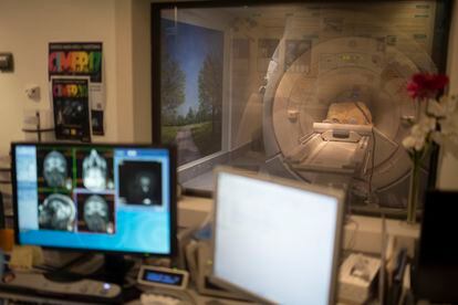 Exame neurológico por imagem em uma paciente com Alzheimer, na Fundação CIEN.