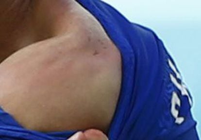 Chiellini mostra a marca dos dentes de Suárez, depois da mordida.