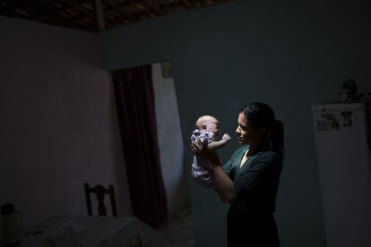 Uma mãe segura a filha, que nasceu com microcefalia, na Paraíba.