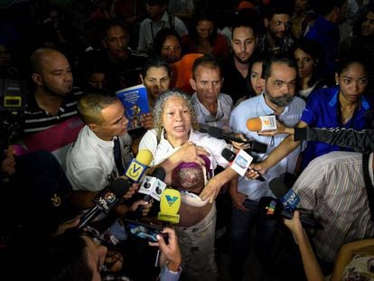 Elizabeth Salazar mostra seu seio esquerdo à imprensa venezuelana.