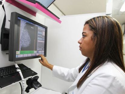 20% das latinas tem uma variante genética que reduz o risco de sofrer câncer de mama em 40%.