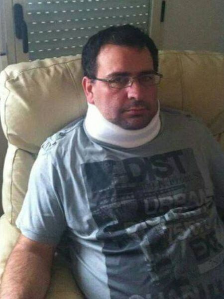 Adolfo Infante, depois da agressão sofrida em outubro de 2013.