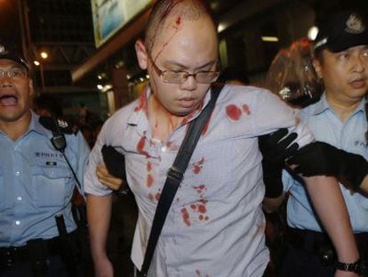 Manifestante pró-democracia ferido por defensores de Pequim.