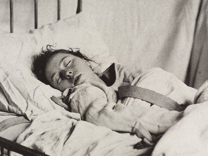 Uma mulher com uma camisa de força, diagnosticada com histeria, em uma foto publicada em 1889.