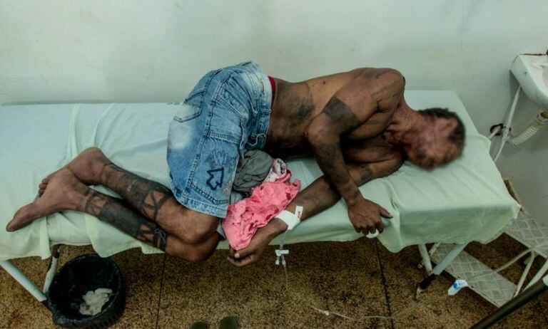 Um dos indígenas hospitalizados após o conflito.
