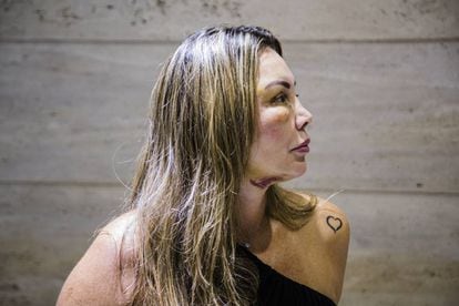 Elaine Caparroz, paisagista, vítima de tentativa de feminicídio
