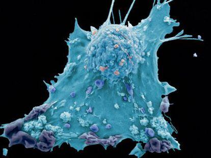 Imagem de uma célula cancerígena de mama.