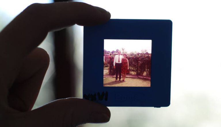Os doentes de Alzheimer não são capazes de lembrar grande parte de suas vidas.