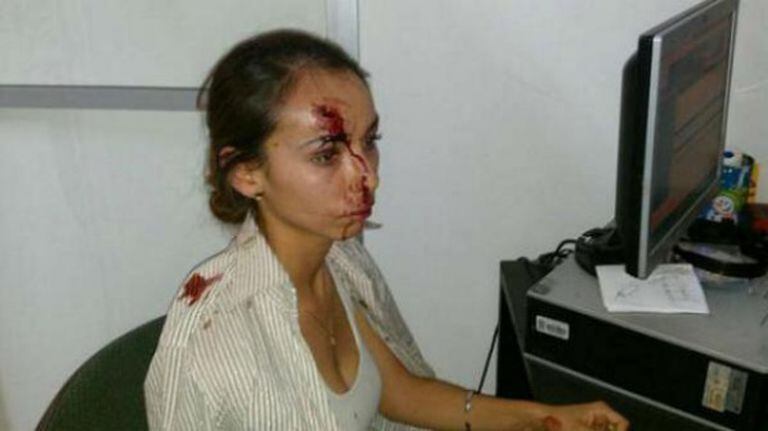 Karla Janeth Silva após a agressão em uma imagem divulgada nas redes sociais.