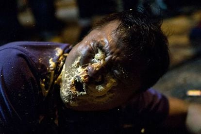 Jornalista de Hong Kong atacado com gás de pimenta na sexta-feira.