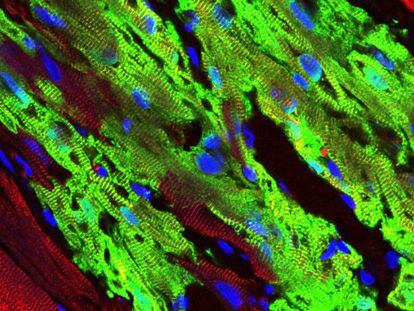 O implante de células humanas (verdes) contém feixes fibrilares e sarcômeros bem formados; células do macaco hóspede em vermelho.