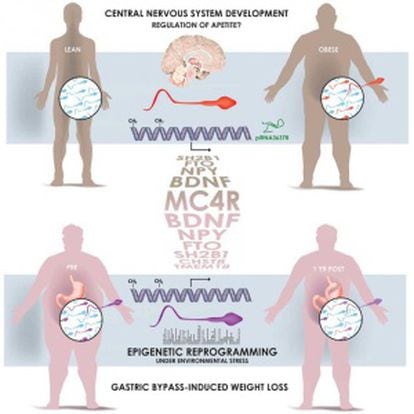 O gráfico mostra como o espermatozoide de um homem obeso tem marcas 'epigenéticas' diferentes da de um magro, depois de se submeter a uma cirurgia de estômago, especialmente nos genes que controlam o desenvolvimento e a função do cérebro.