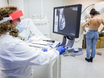 Uma mulher faz uma mamografia em um hospital da Catania (Itália), no ano passado.