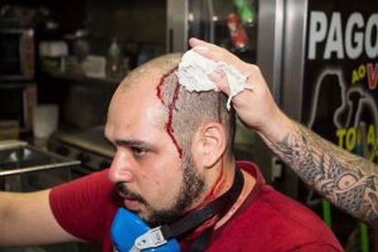 Tarek Mahammed, fotojornalista ferido durante o protesto.