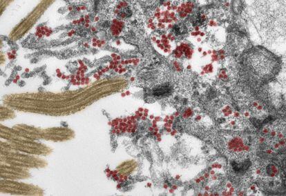 Pedaço de célula da mucosa olfativa observada ao microscópio, com as partículas do coronavírus destacadas em vermelho (a cor não é real).