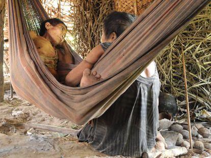Jakarewyj, mulher awá, jaz gravemente doente em uma rede junto a sua irmã Amakaria, em abril de 2015, pouco depois do primeiro contato com a sociedade exterior.