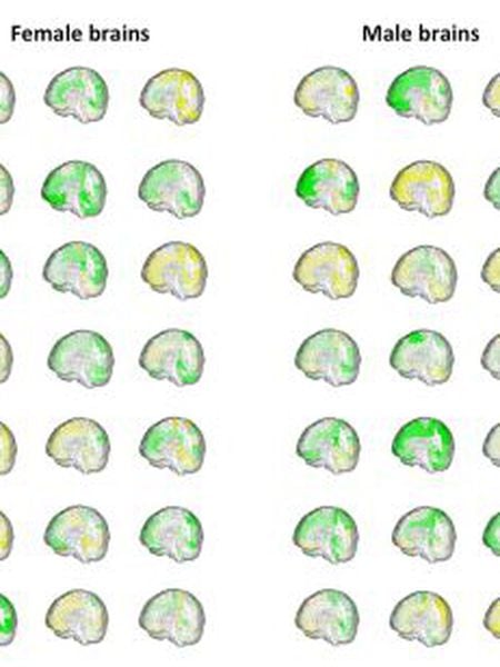O volume das diferentes regiões cerebrais (em verde, maior; em amarelo, menor) de 42 pessoas mostra como os cérebros masculinos e femininos se sobrepõem.