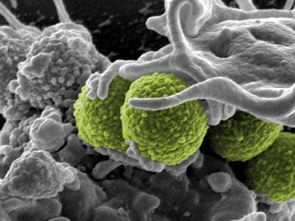 O Staphylococcus aureus, na imagem batalhando com linfócitos, desenvolveu resistência a vários antibióticos.
