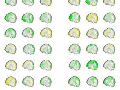 O volume das diferentes regiões cerebrais (em verde, maior; em amarelo, menor) de 42 pessoas mostra como os cérebros masculinos e femininos se sobrepõem.
