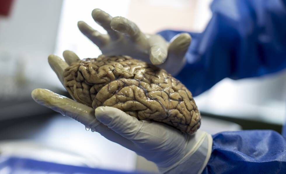 O pesquisador David Aguillón mostra os cérebros do neurobanco do Grupo de Neurociências da Universidade de Antioquia.