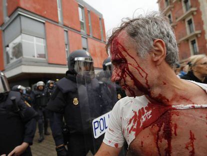 Ferido na ação policial em Barceloneta.
