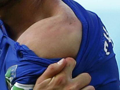 Chiellini mostra a marca dos dentes de Suárez, após a mordida.