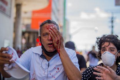 Daniel Campelo da Silva, 51 anos, que ficou cego de um olho a após ser atingido por uma bala de borracha da polícia, que dispersou violentamente o protesto neste sábado.