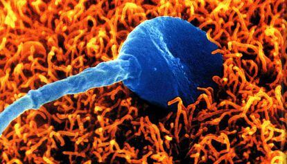 Um espermatozoide humano tenta fecundar um óvulo.