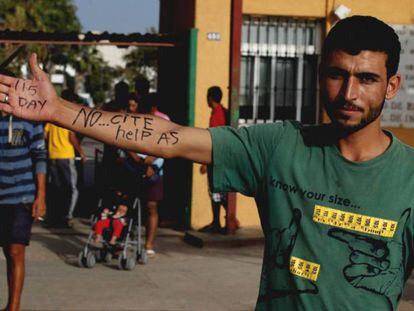 Um cidadão sírio residente no CETI de Melilla escreve no braço, pedindo ajuda
