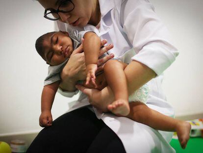 Médica faz terapia em bebê nascido com microcefalia.
