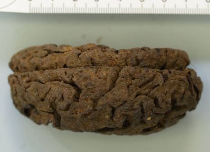 Um dos 45 cérebros preservados em La Pedraja.