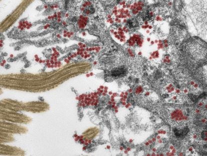 Pedaço de célula da mucosa olfativa observada ao microscópio, com as partículas do coronavírus destacadas em vermelho (a cor não é real).