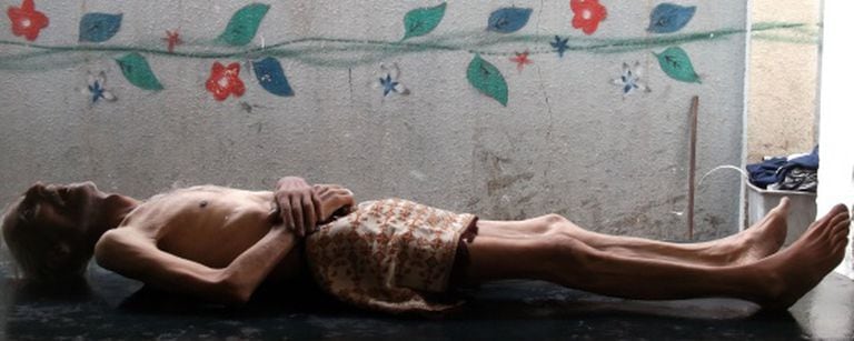 O corpo de Awad al-Said, que morreu de fome, segundo moradores de Yarmuk, em Damasco. / AP