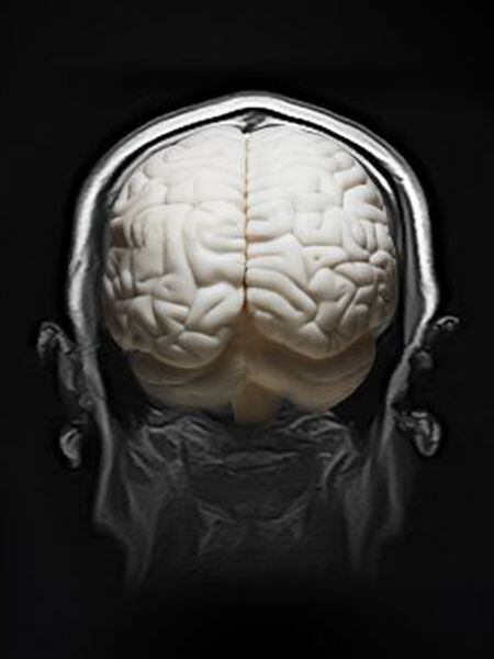 Os processos de destruição cerebral e os de ativação celular se contrapõem.