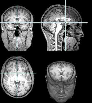 O estudo do cérebro de Gareyev mostrou conexões extraordinárias entre diferentes partes.