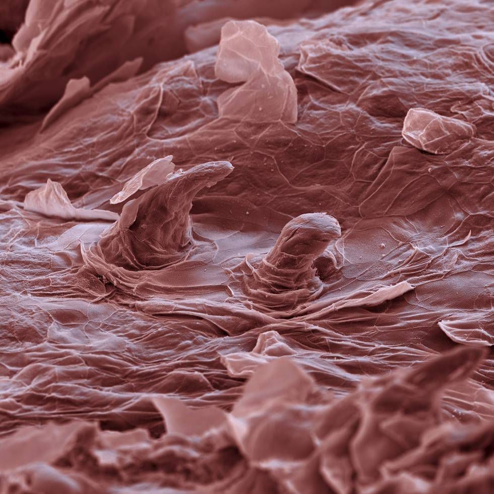 <b>Viagem ao centro do corpo.</b> A micrografia eletrônica de varredura (SEM) em cores abre uma perspectiva completamente nova sobre nosso corpo. Nesta imagem, observam-se as células epiteliais que recobrem a superfície da língua humana.